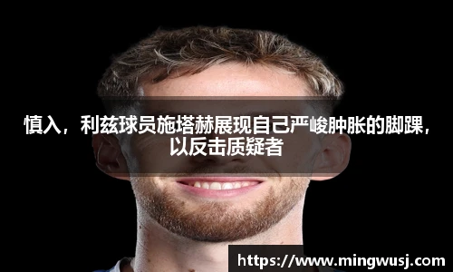 慎入，利兹球员施塔赫展现自己严峻肿胀的脚踝，以反击质疑者